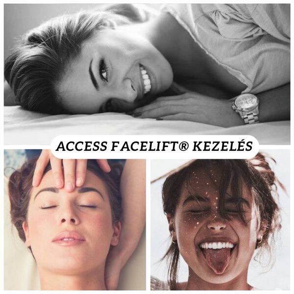 Access Facelift kezelés